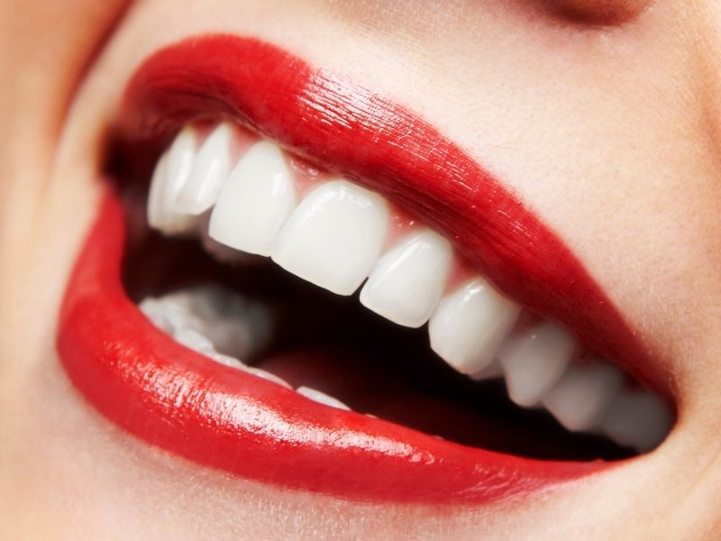 A Clean Looking Smile With Teeth Whitening