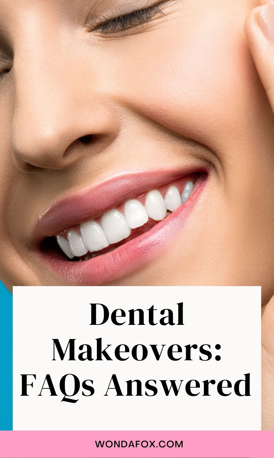 Dental Makeovers: FAQs Answered  