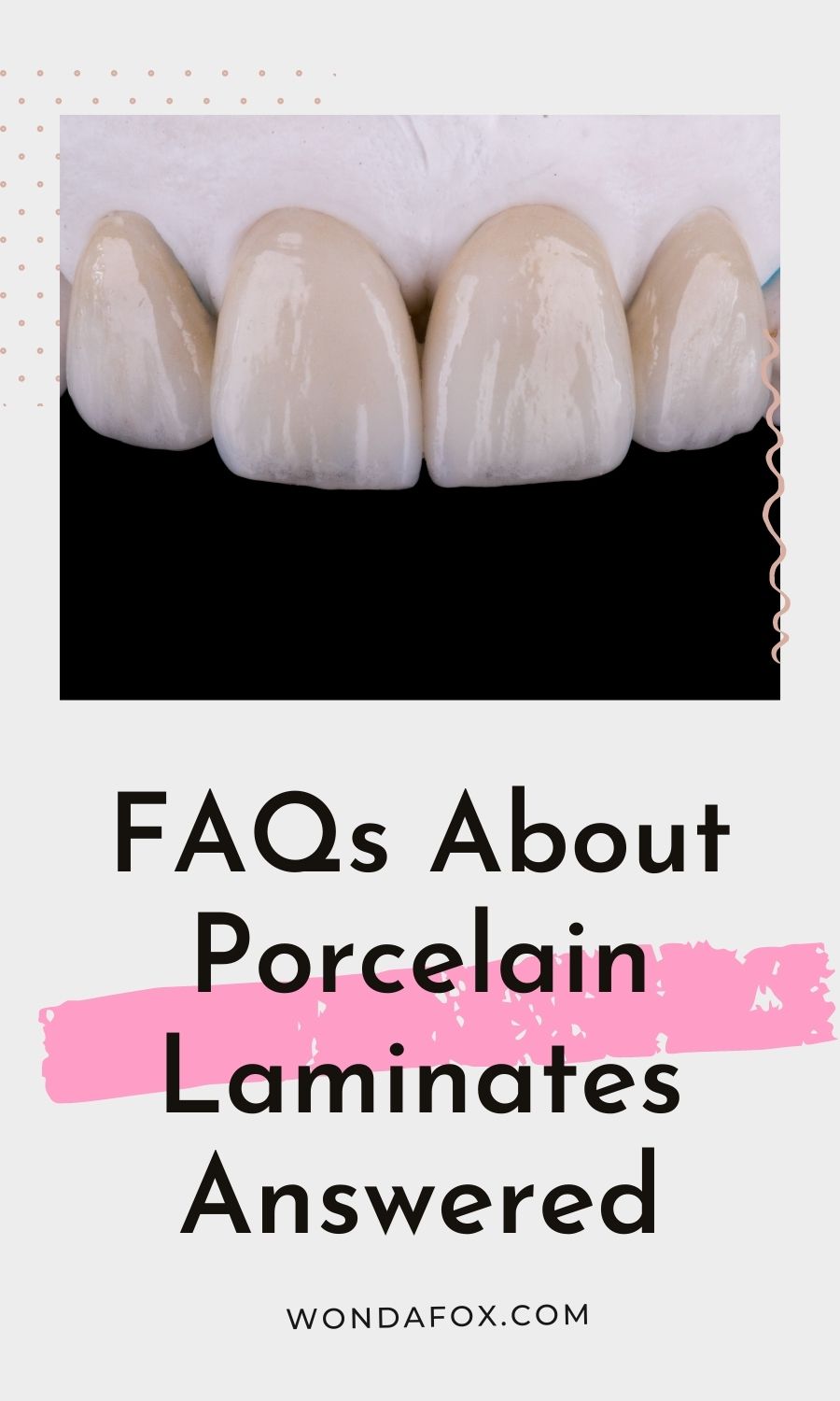 FAQs About Porcelain Laminates Answered