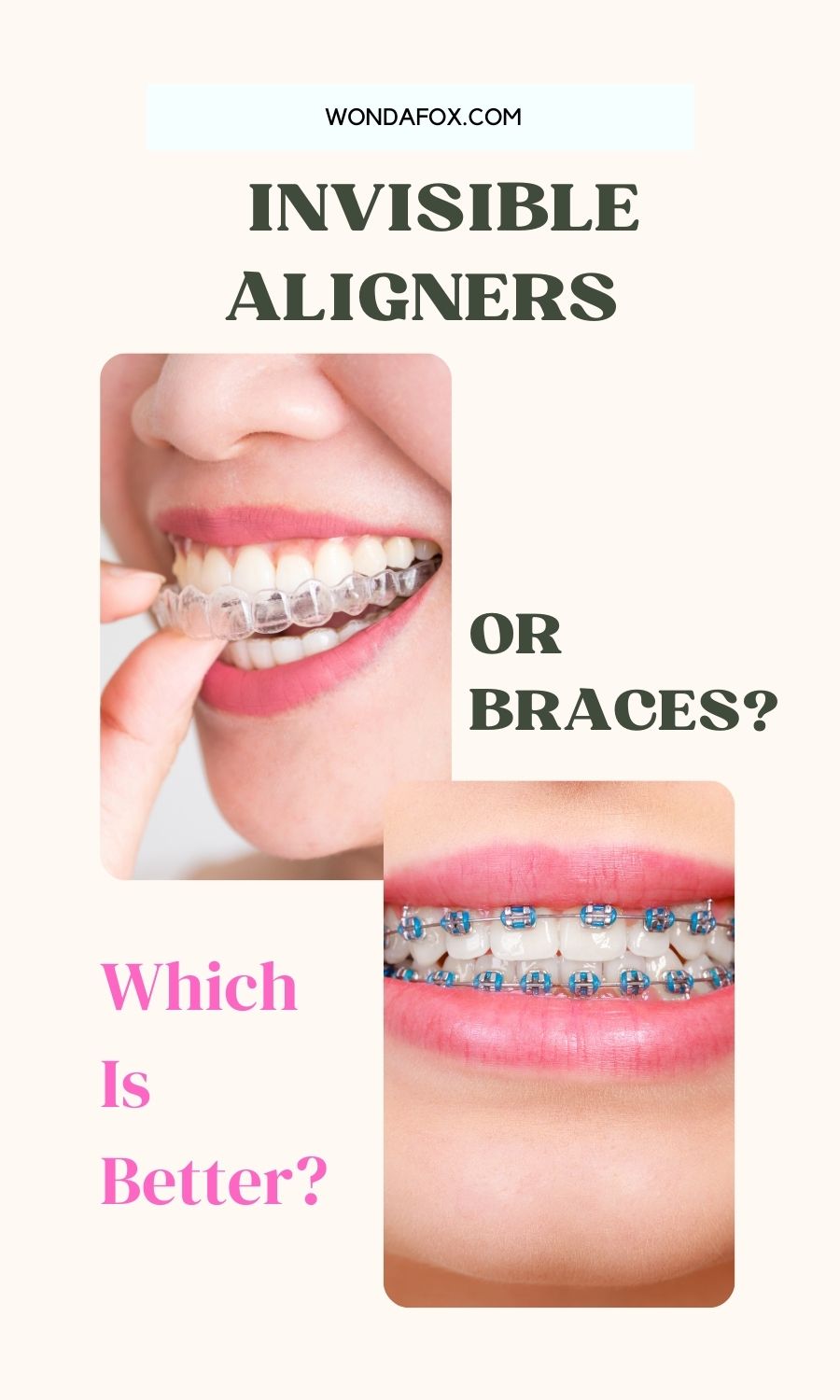 Invisible Aligners Or Braces? Which Is Better?